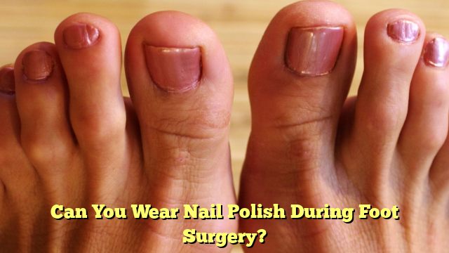 Can You Wear Nail Polish During Foot Surgery? - Bobby Orthopedics