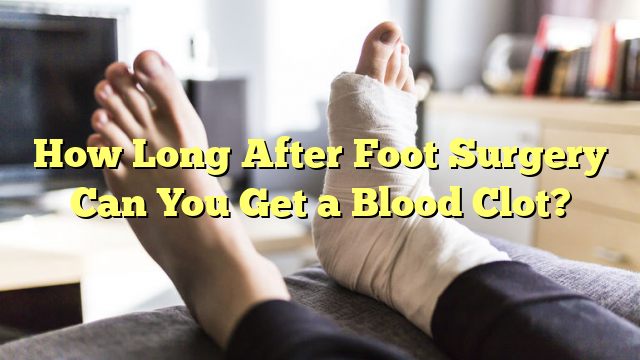 How Long After Foot Surgery Can You Get a Blood Clot?