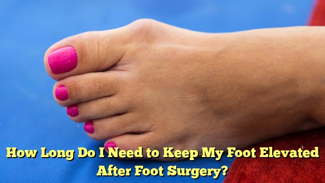 How Long Do I Need to Keep My Foot Elevated After Foot Surgery?
