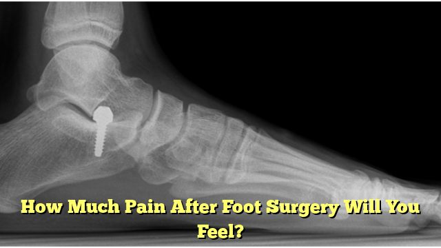 How Much Pain After Foot Surgery Will You Feel?
