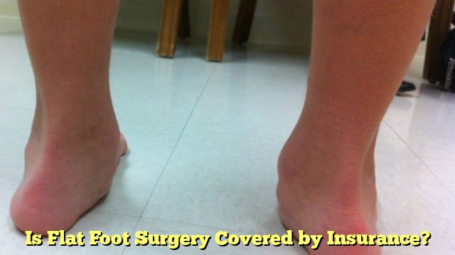 Is Flat Foot Surgery Covered by Insurance?