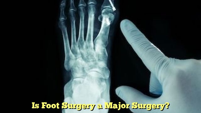 Is Foot Surgery a Major Surgery?